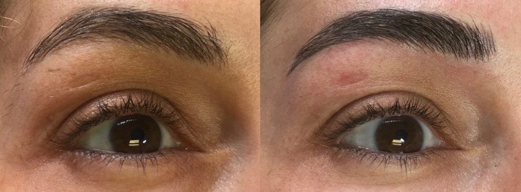 Microblading IN KENT